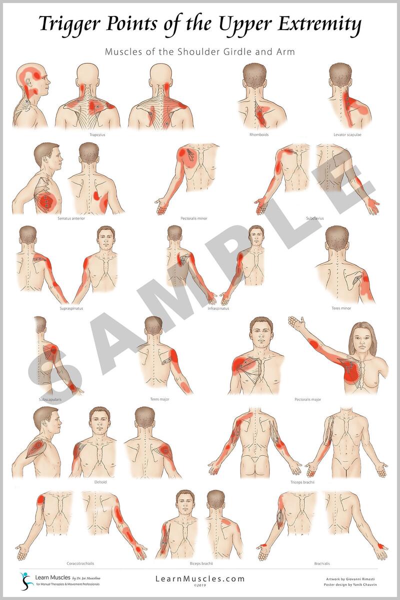 Upper Body Trigger Point Chart Muscle Anatomy Art Chiropractic Massage Therapist Office Wall Art Gym Art Etsy