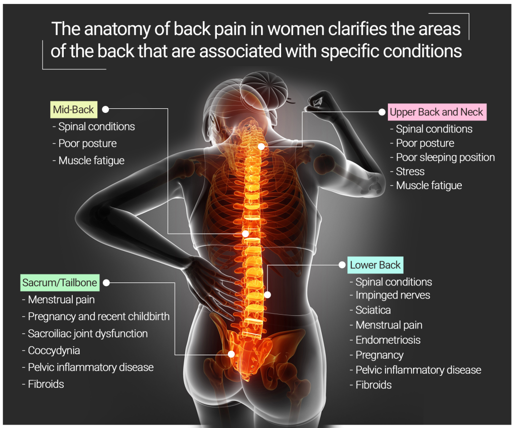 Understanding Female Back Pain Causes And Symptoms Chart
