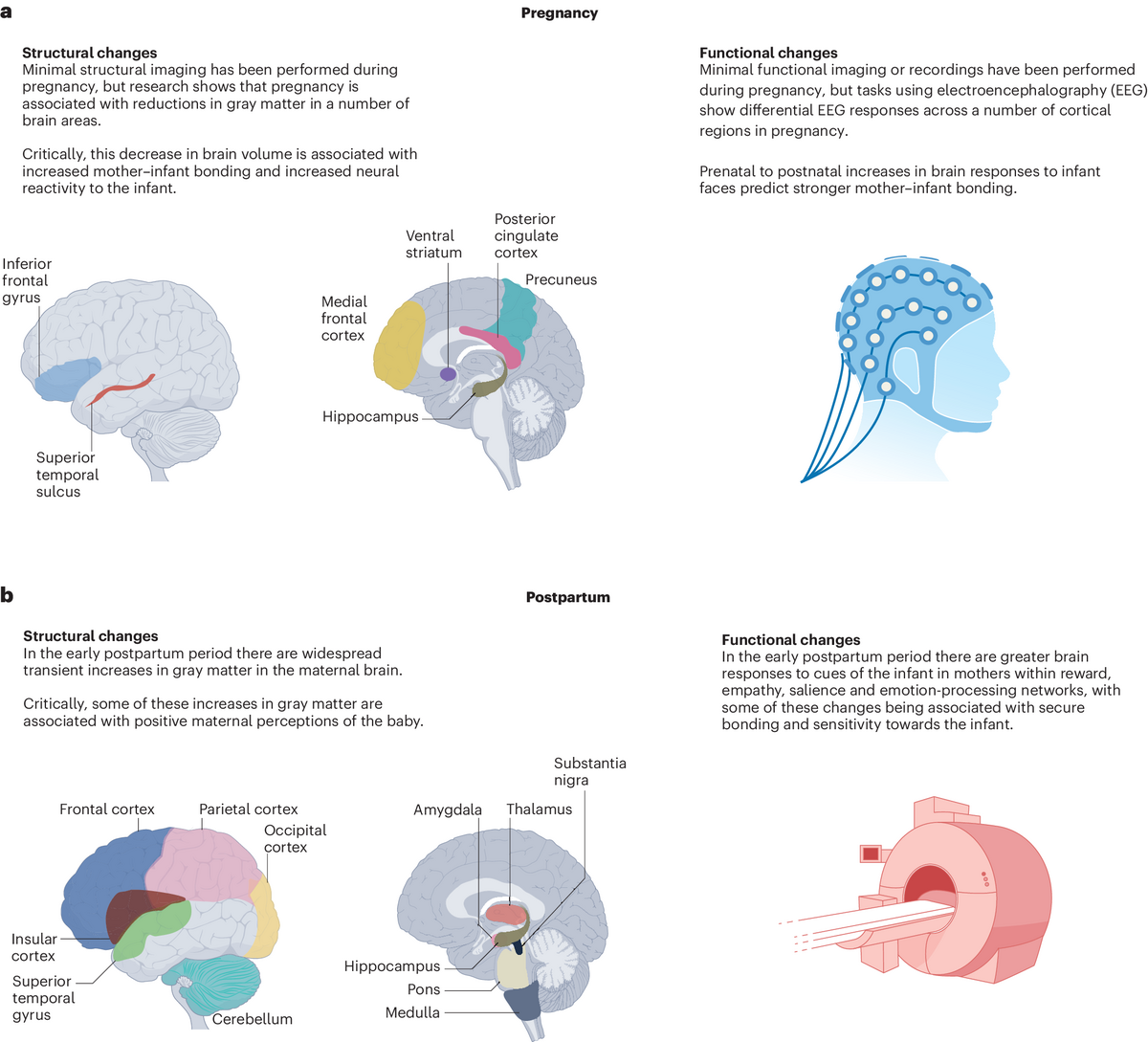 Understanding The Maternal Brain In The Context Of The Mental Load Of Motherhood Nature Mental Health