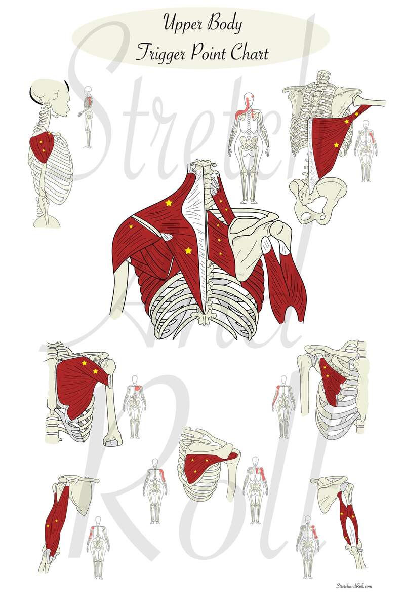 Upper Body Trigger Point Chart Muscle Anatomy Art Chiropractic Massage Therapist Office Wall Art Gym Art Etsy