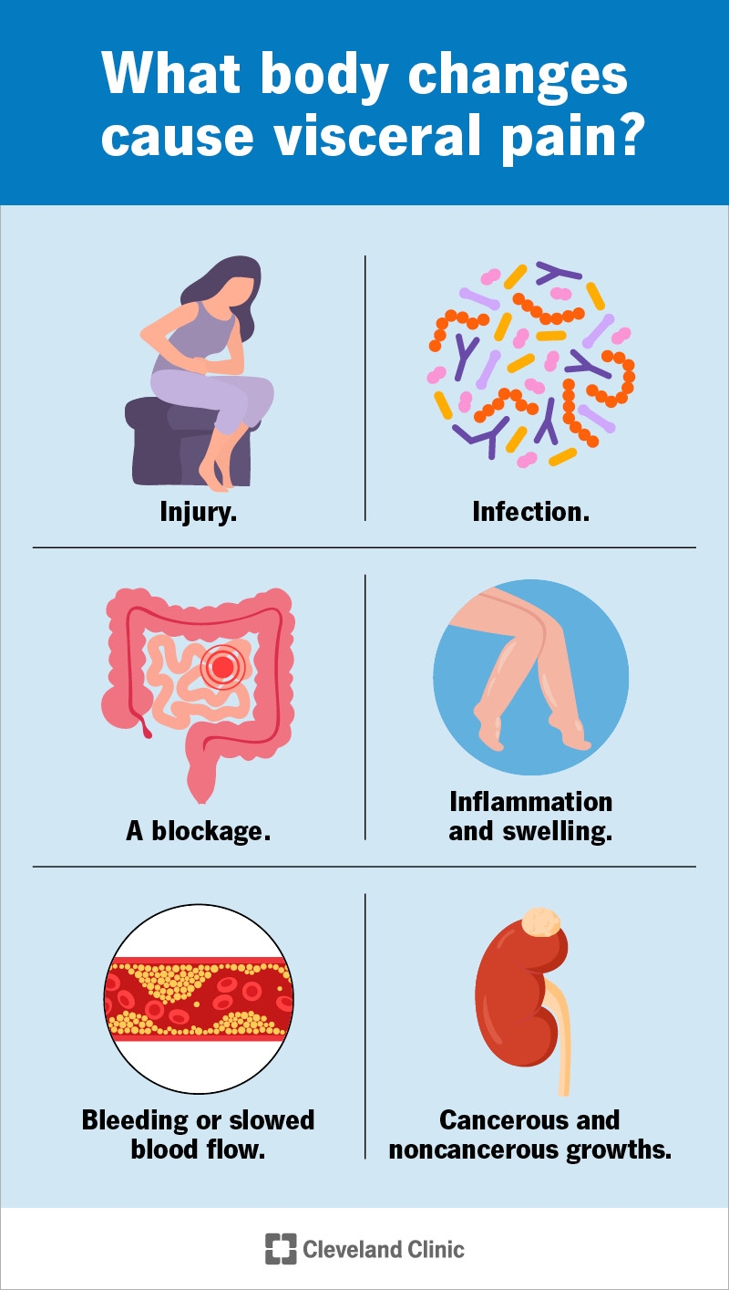 Visceral Pain What It Is Vs Somatic Causes Treatment Visceral Pain What It Is Vs Somatic Causes Treatment
