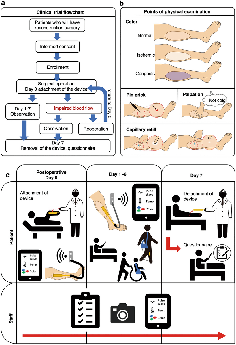 Wearable Wireless Multi Sensor Device For Monitoring Tissue Circulation After Free Tissue Transplantation A Multicentre Clinical Trial Scientific Reports Wearable Wireless Multi Sensor Device For Monitoring Tissue Circulation After Free Tissue Transplantation A Multicentre Clinical Trial Scientific Reports