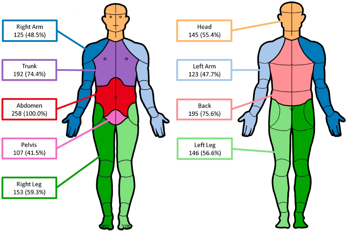 Whole Body Pain Distribution And Risk Factors For Widespread Pain Among Patients Presenting With Abdominal Pain A Retrospective Cohort Study Pain And Therapy